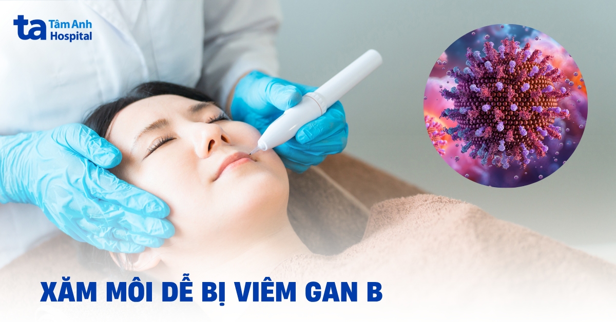Đi xăm môi dễ bị viêm gan B không?