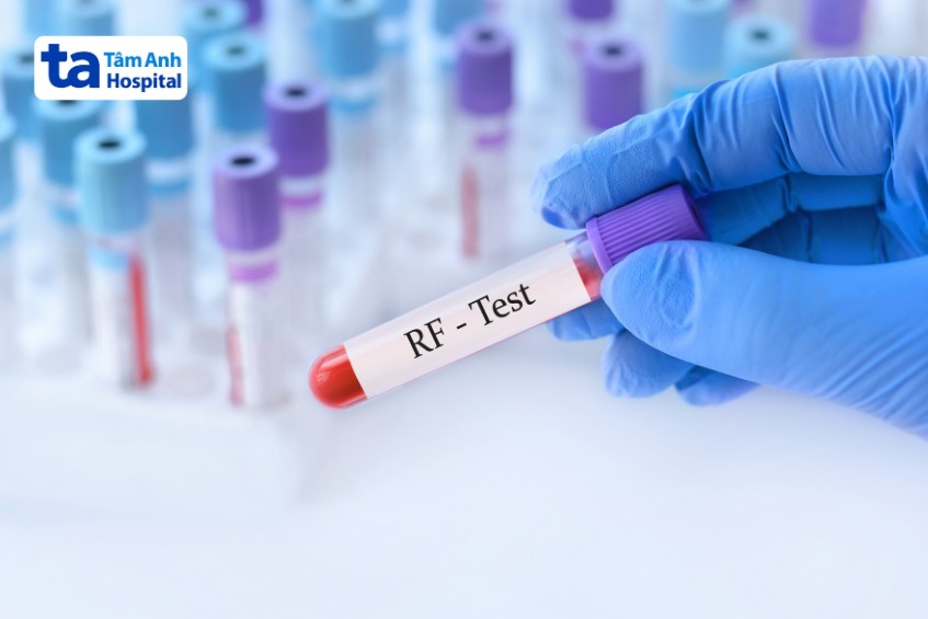 xét nghiệm anti cpp thực hiện cùng xét nghiệm rf