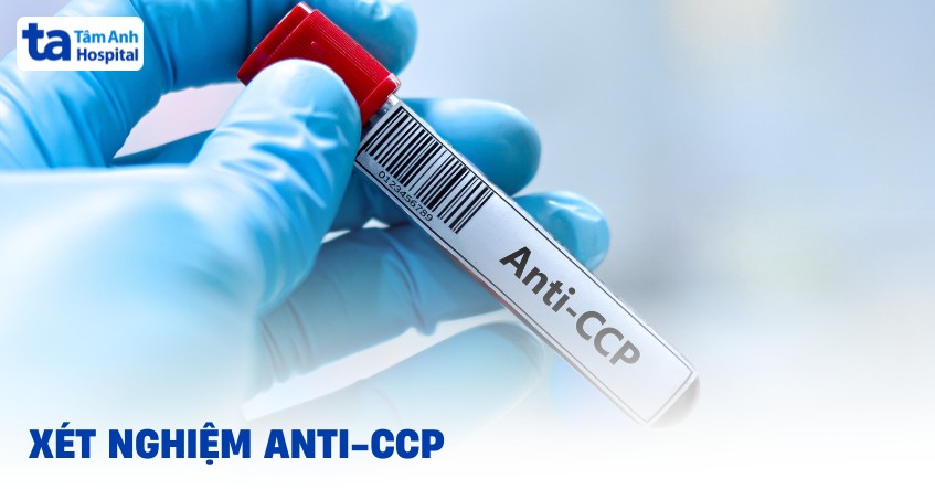Xét nghiệm Anti-CCP trong chẩn đoán viêm khớp dạng thấp là gì?