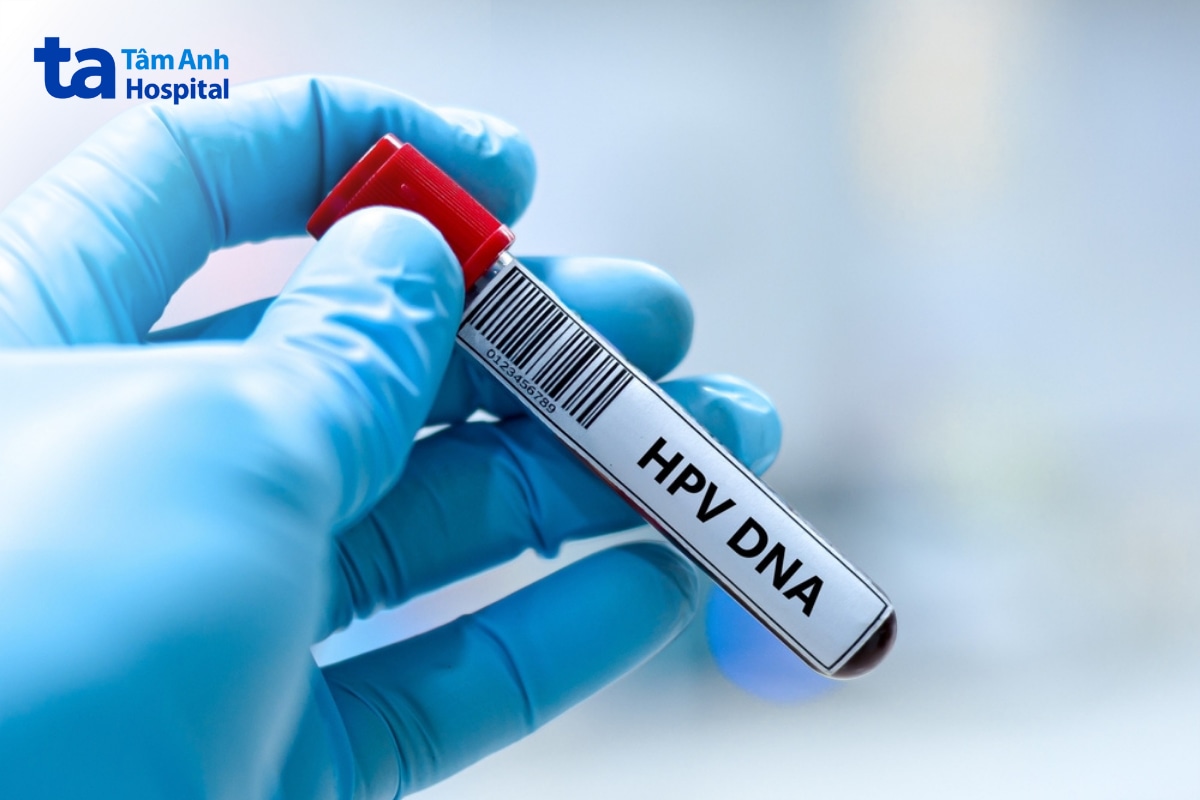 Mẫu máu dùng trong xét nghiệm DNA HPV