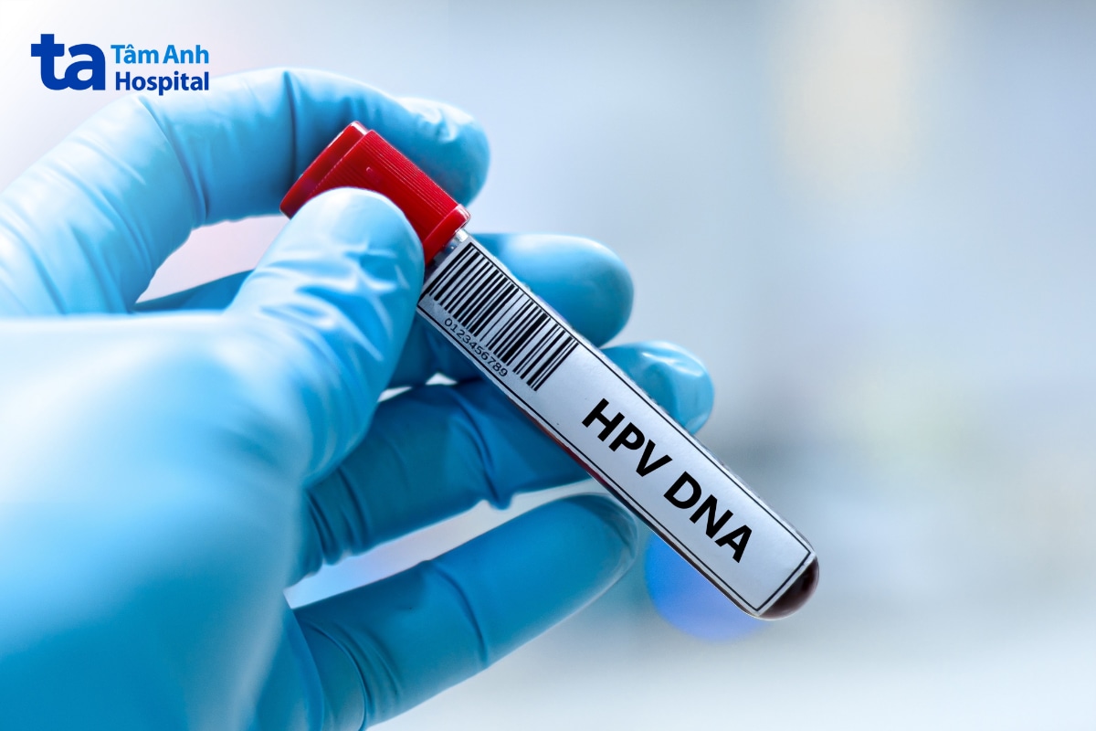Mẫu xét nghiệm DNA phát hiện HPV type 56