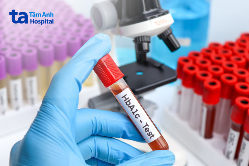 xét nghiệm hba1c