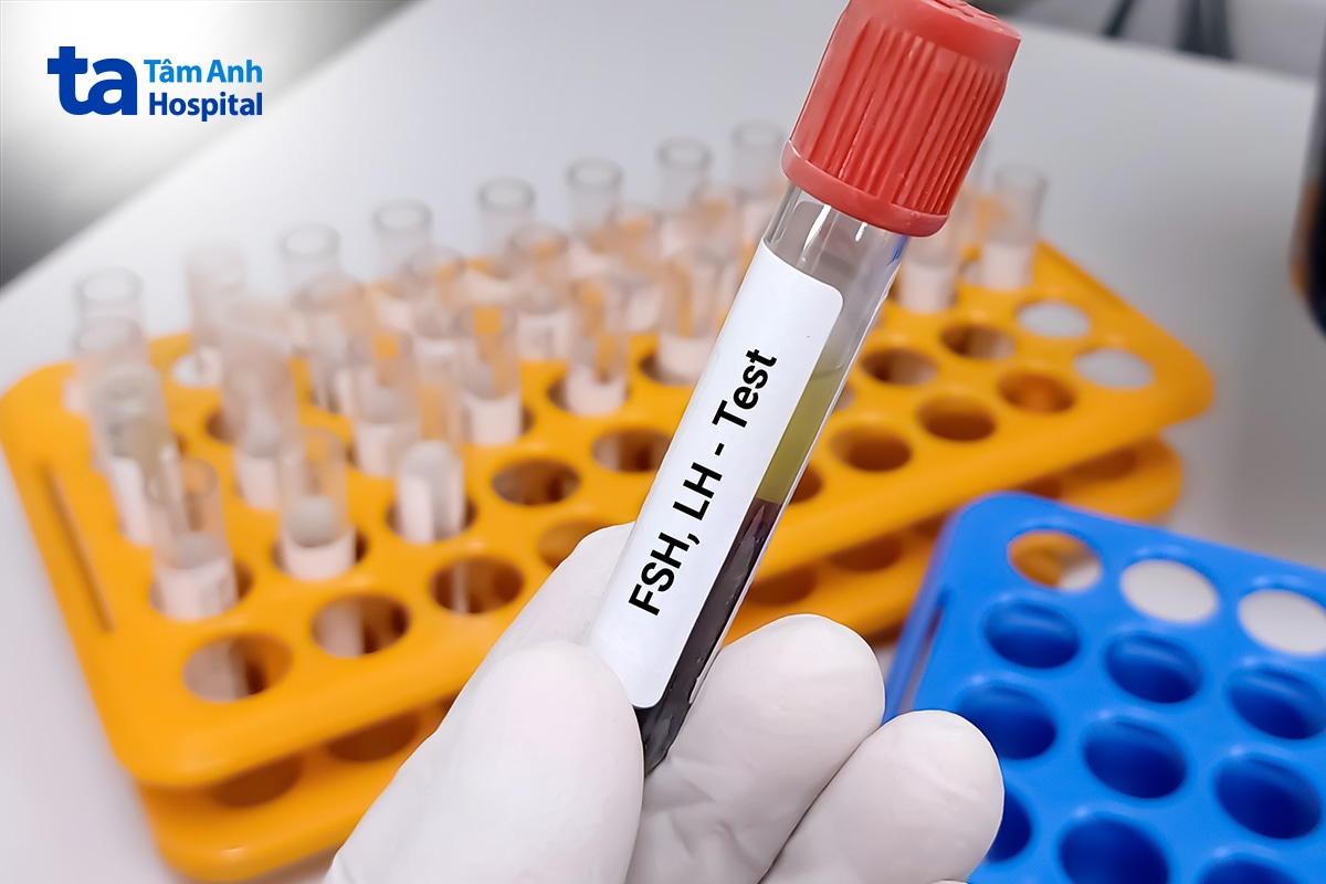 Xét nghiệm hormone LH và FSH hỗ trợ chẩn đoán dậy thì sớm.