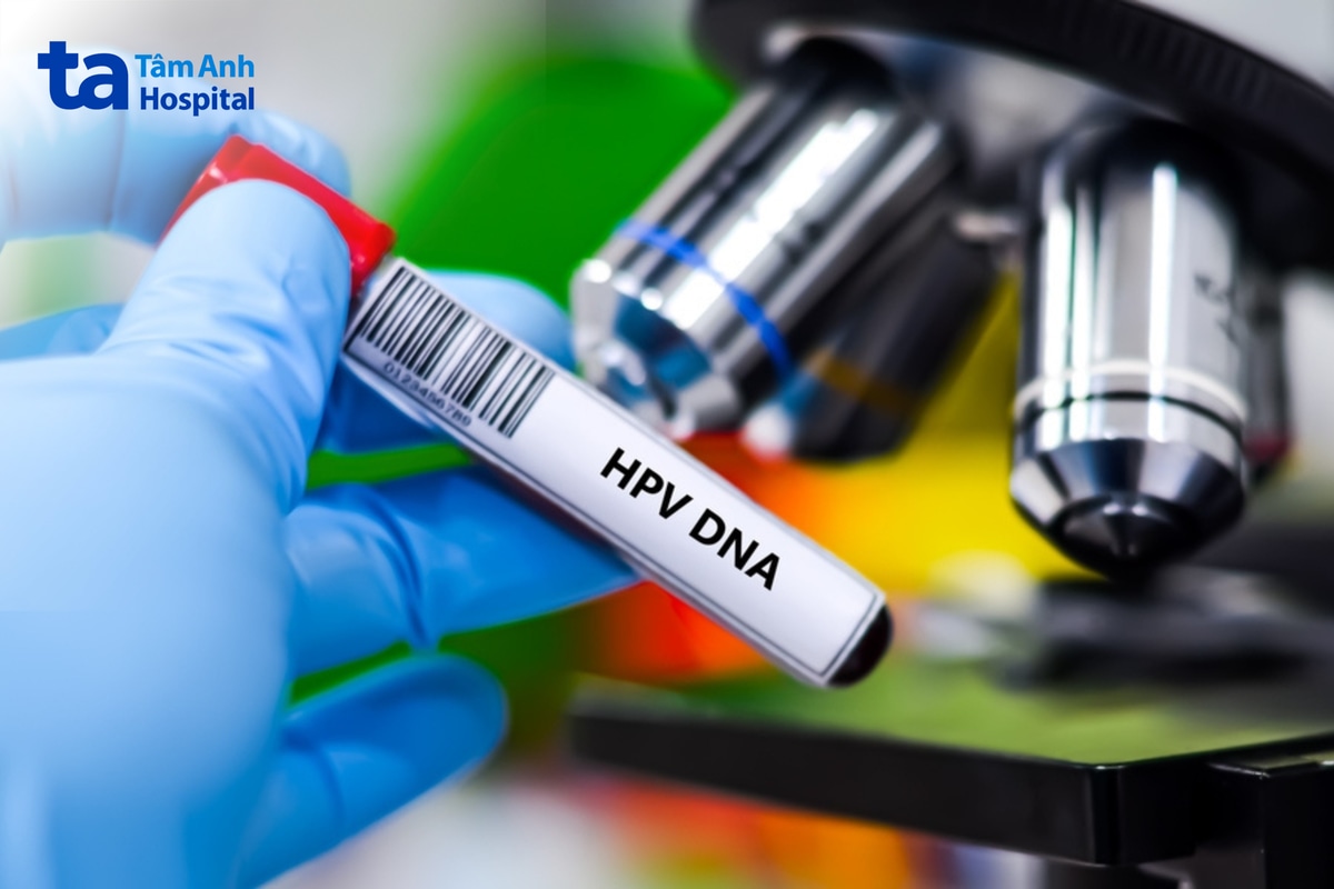 Xét nghiệm HPV DNA phát hiện chủng virus nguy cơ cao