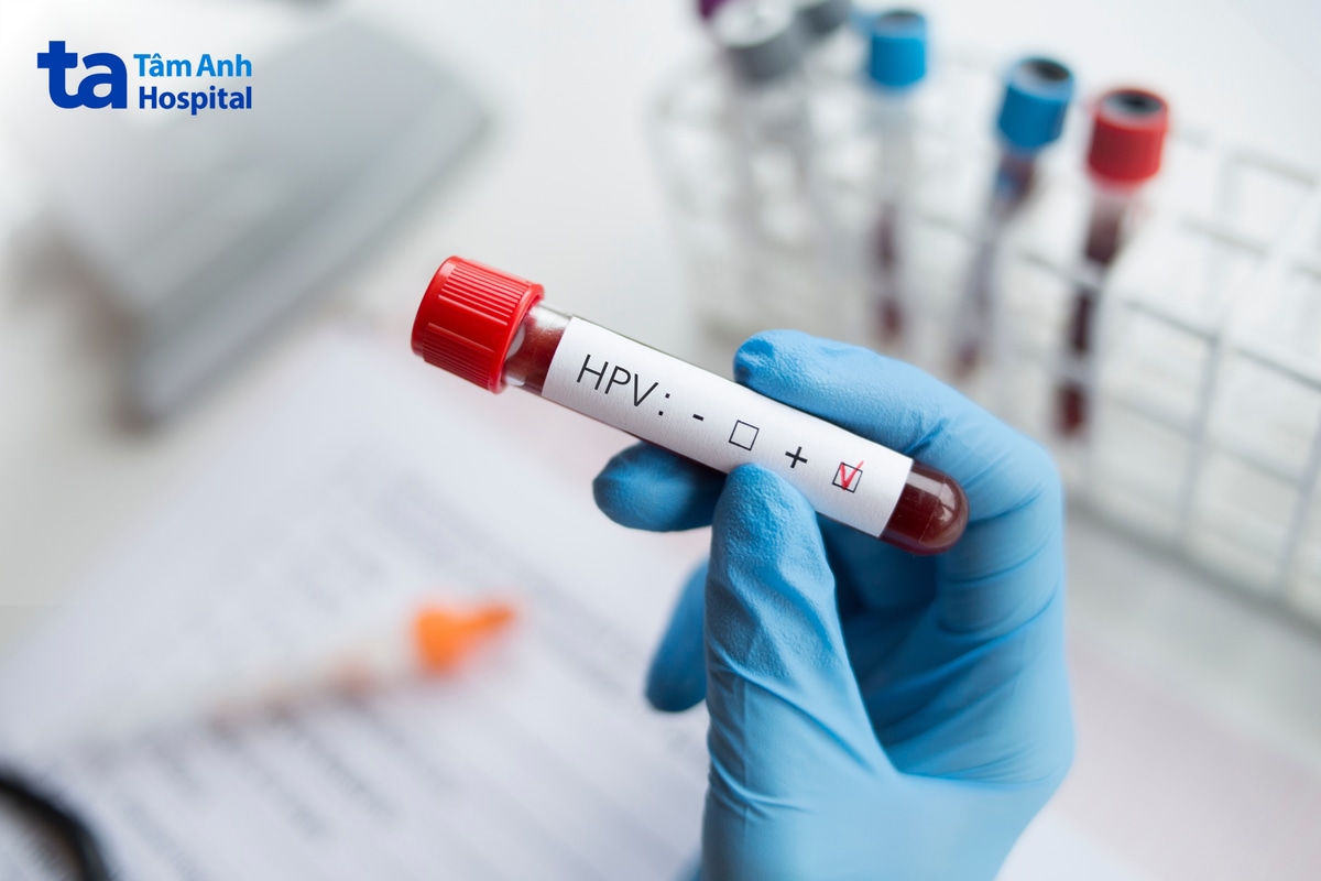 Minh họa xét nghiệm phát hiện HPV nguy cơ cao