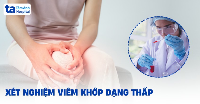 Xét nghiệm viêm khớp dạng thấp gồm những gì? Ý nghĩa chỉ số
