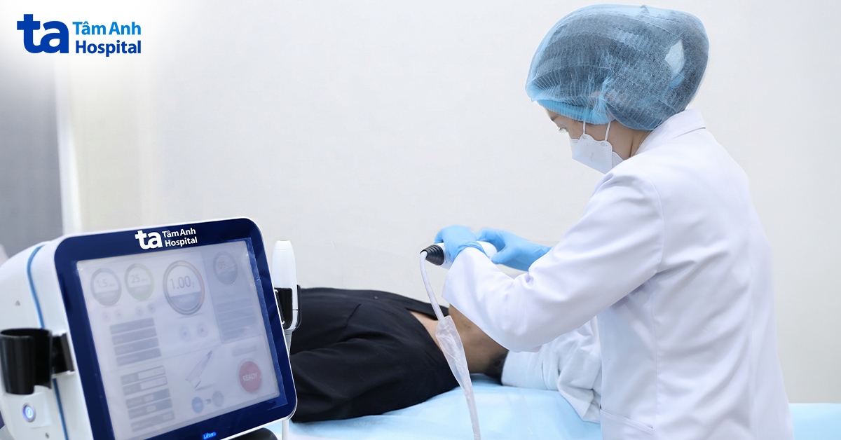 Xóa mỡ nọng cằm cho nam thanh niên