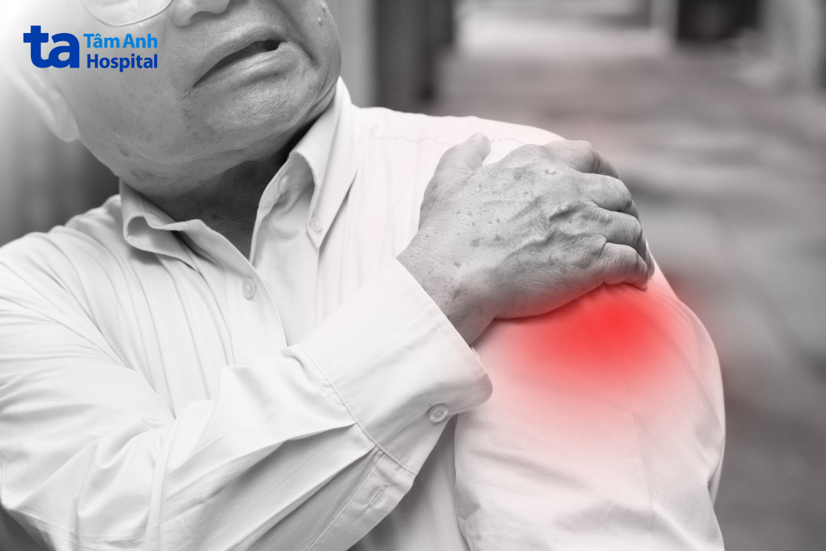 xử lý thoát mạch sai gây sưng đau
