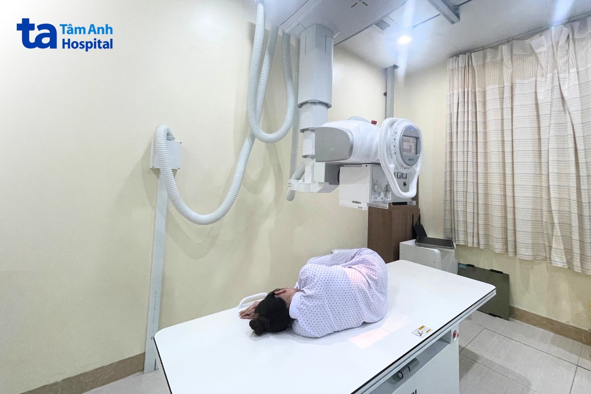 yếu tố ảnh hưởng chi phí chụp X quang lưng