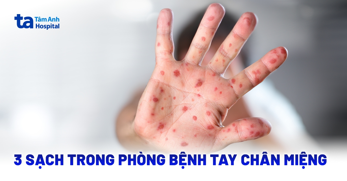 Nguyên tắc 3 sạch trong phòng bệnh tay chân miệng