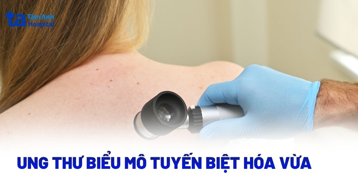 Ung thư biểu mô tuyến biệt hóa vừa là gì? Giải đáp
