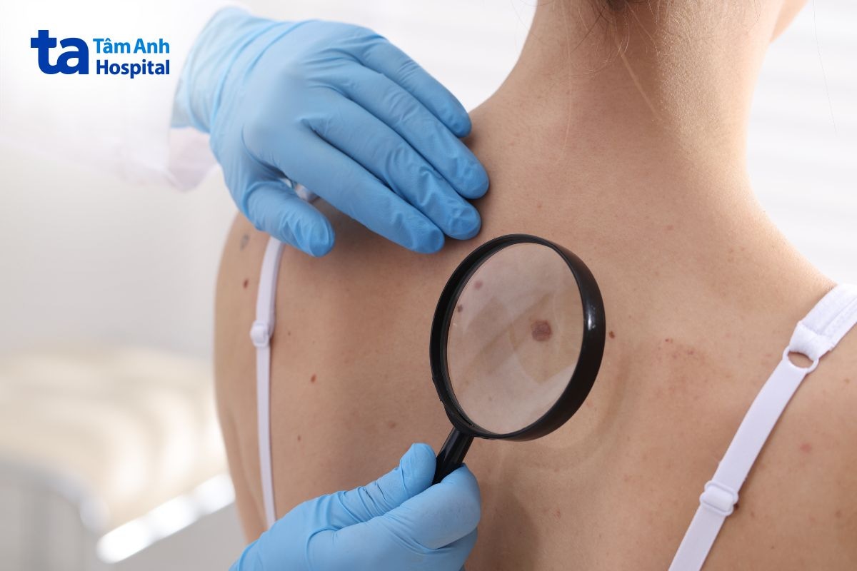 ung thư biểu mô tuyến biệt hóa vừa là gì