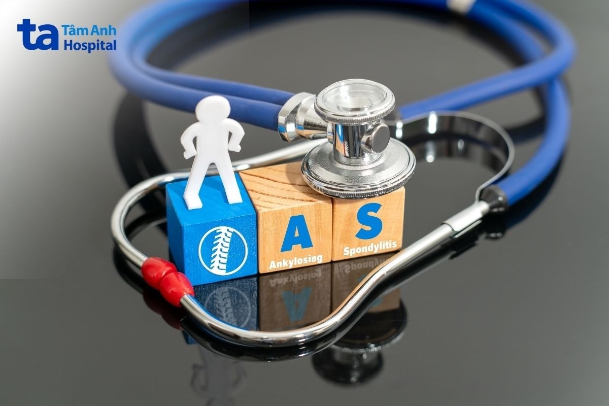 bài tập phục hồi chức năng viêm cột sống dính khớp