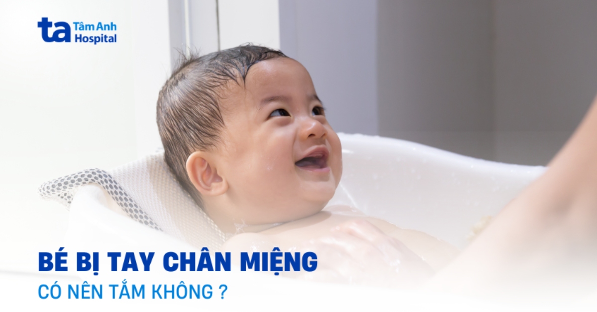 Trẻ bị chân tay miệng có được tắm không? Cẩn trọng điều gì?