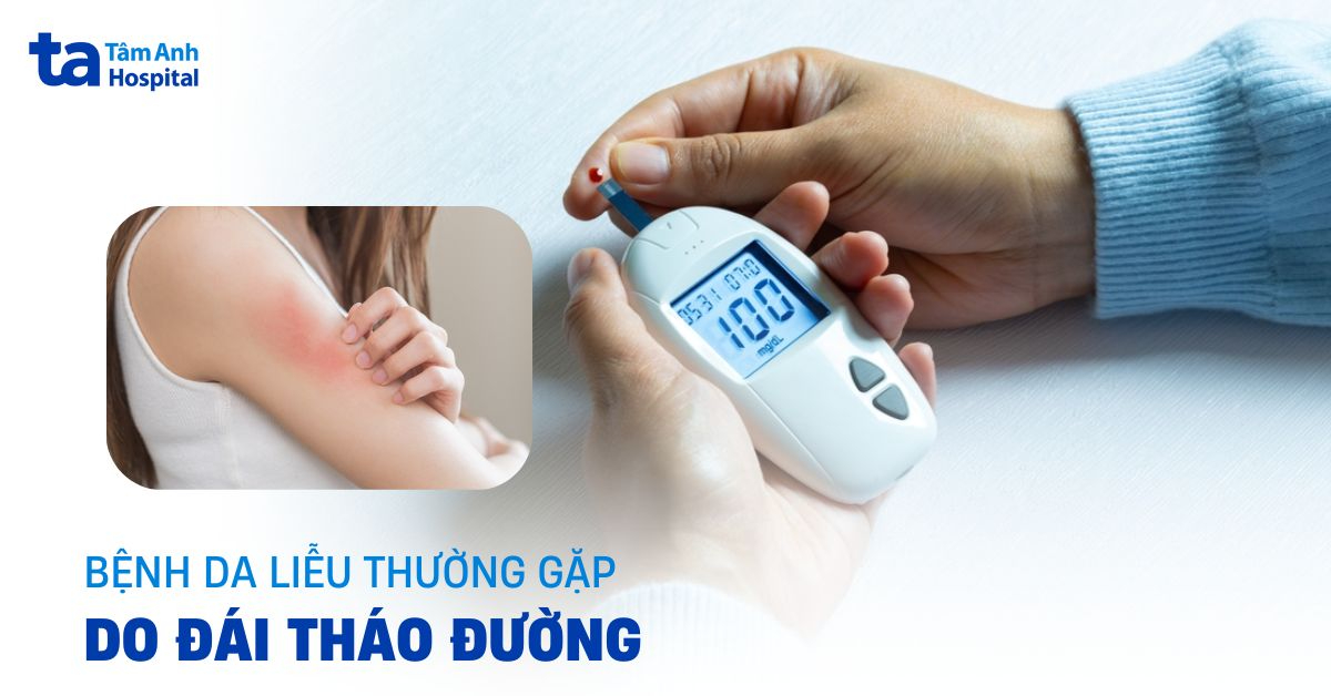 Bệnh da thường gặp ở bệnh nhân đái tháo đường