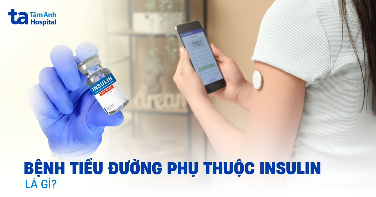 Bệnh tiểu đường phụ thuộc insulin là gì? Làm sao nhận biết sớm?