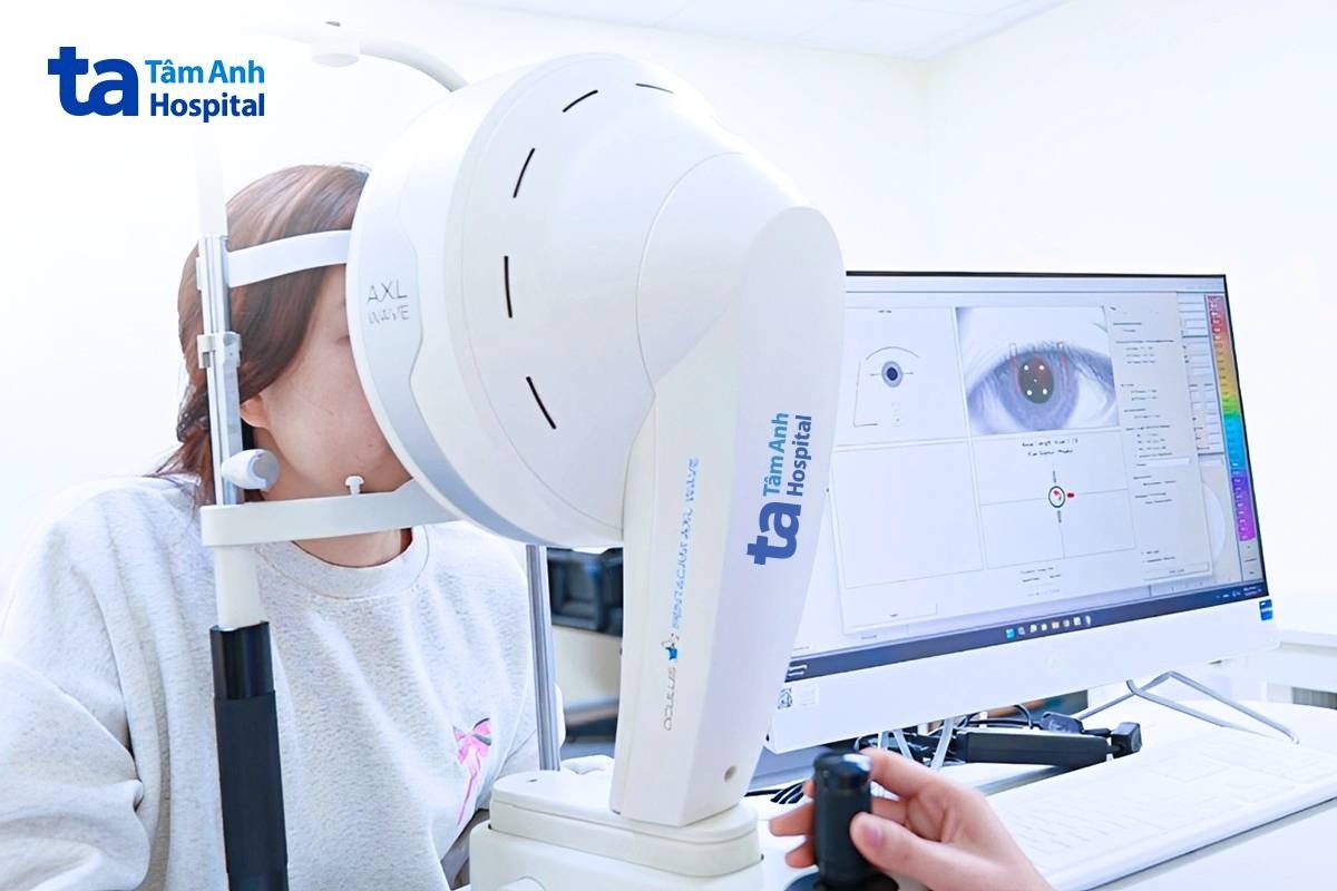 bị cận 16 độ có mổ được không