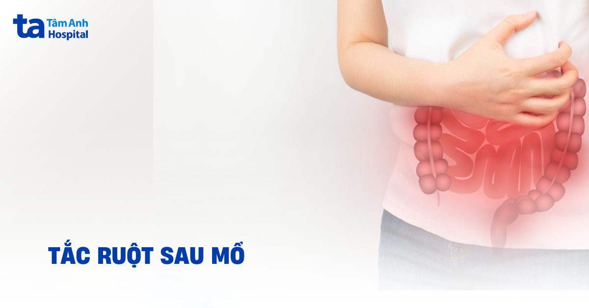 Tắc Ruột Sau Mổ