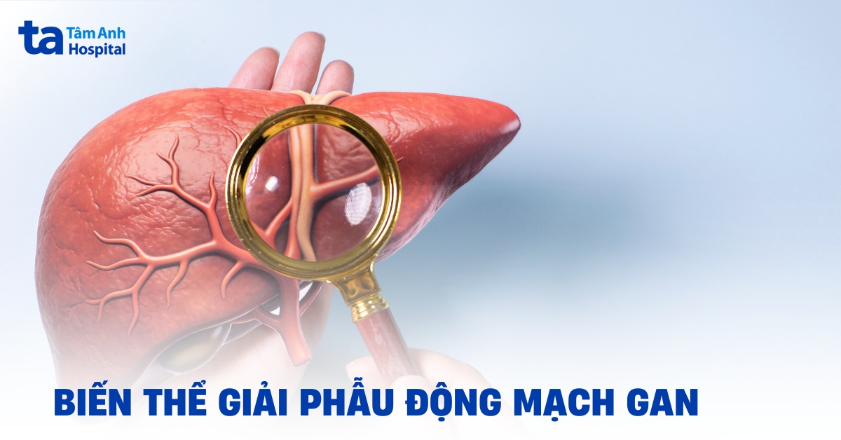 Biến Thể Giải Phẫu Động Mạch Gan