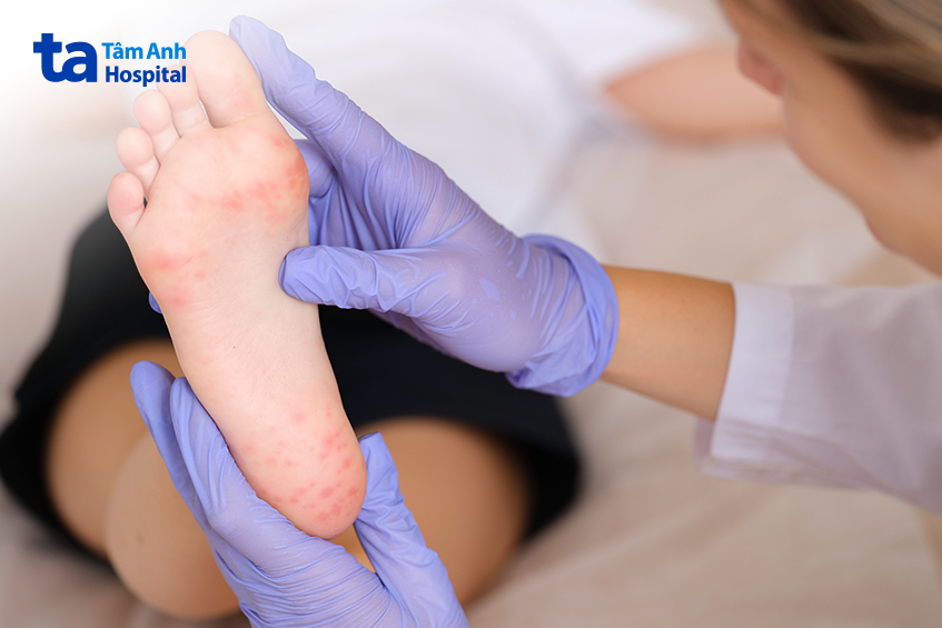 cần thăm khám sớm khi xuất hiện dấu hiệu bất thường