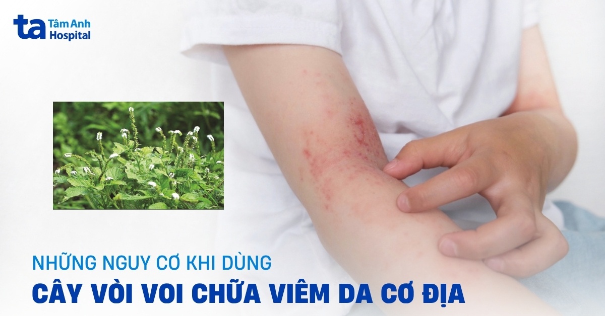 Thực hư cây vòi voi chữa viêm da cơ địa có đúng y khoa?