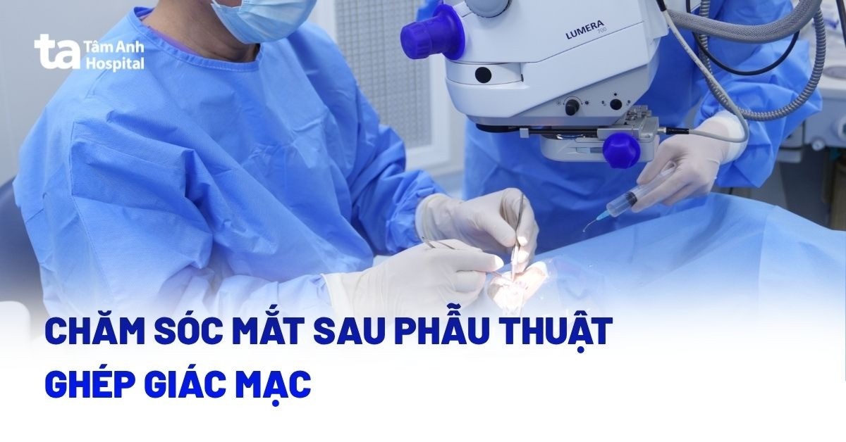 Hướng dẫn cách chăm sóc mắt sau phẫu thuật ghép giác mạc
