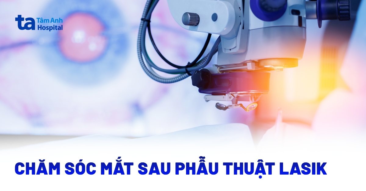 Hướng dẫn cách chăm sóc mắt sau phẫu thuật LASIK