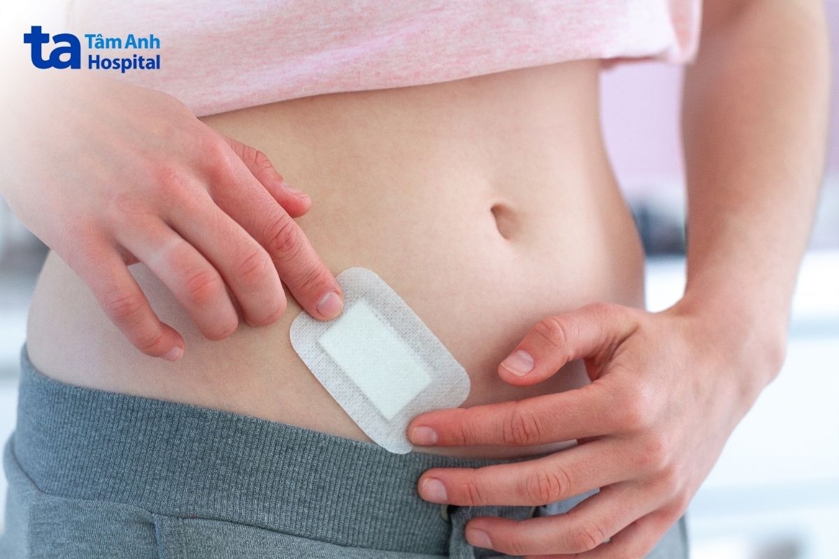 chăm sóc vết mổ đúng cách