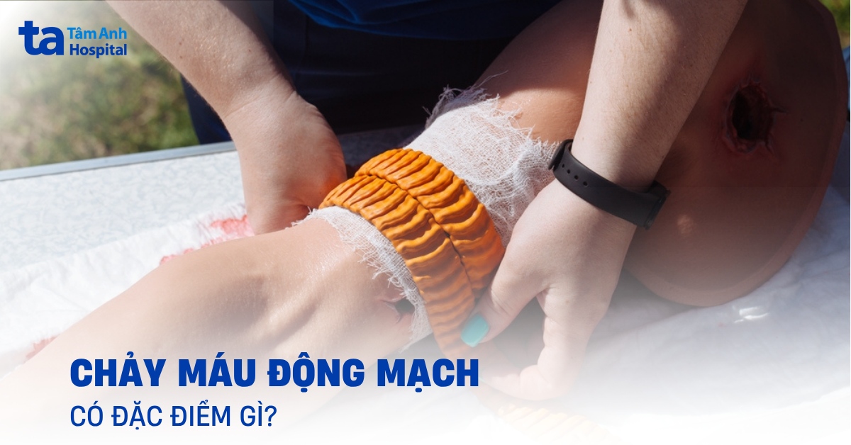 Chảy Máu Động Mạch