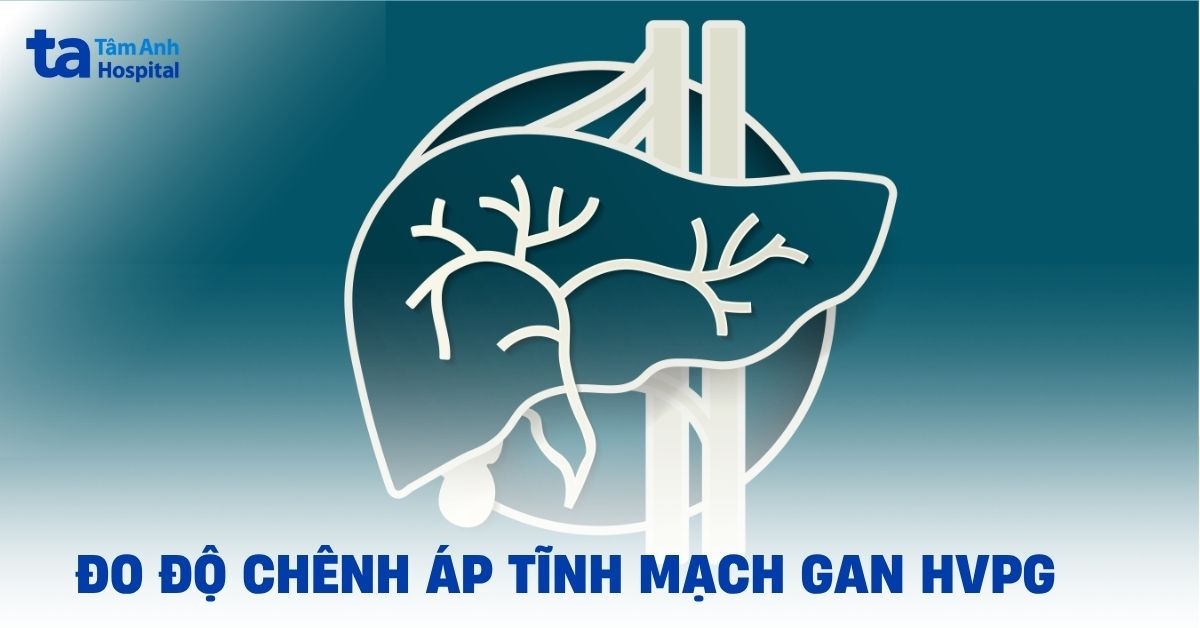 Đo độ chênh áp tĩnh mạch gan HVPG: Ứng dụng lâm sàng