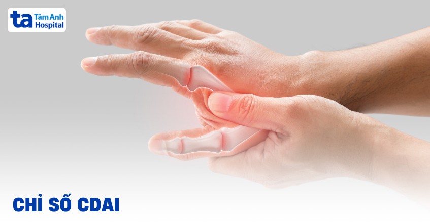 Chỉ số CDAI viêm khớp dạng thấp​: Ý nghĩa và cách tính