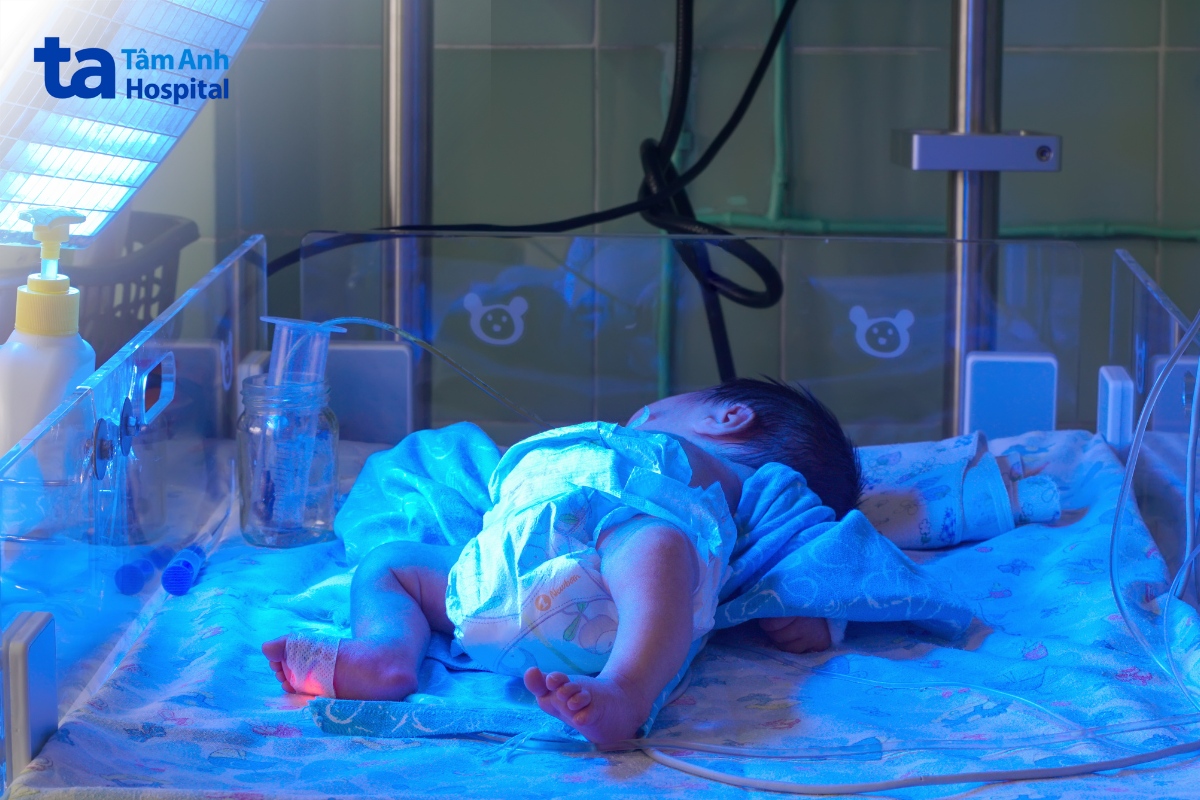 Chiếu Đèn Cho Trẻ Sơ Sinh Vàng Da