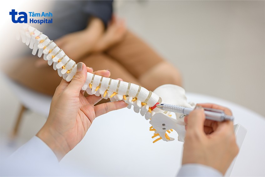 chữa thoái hóa cột sống