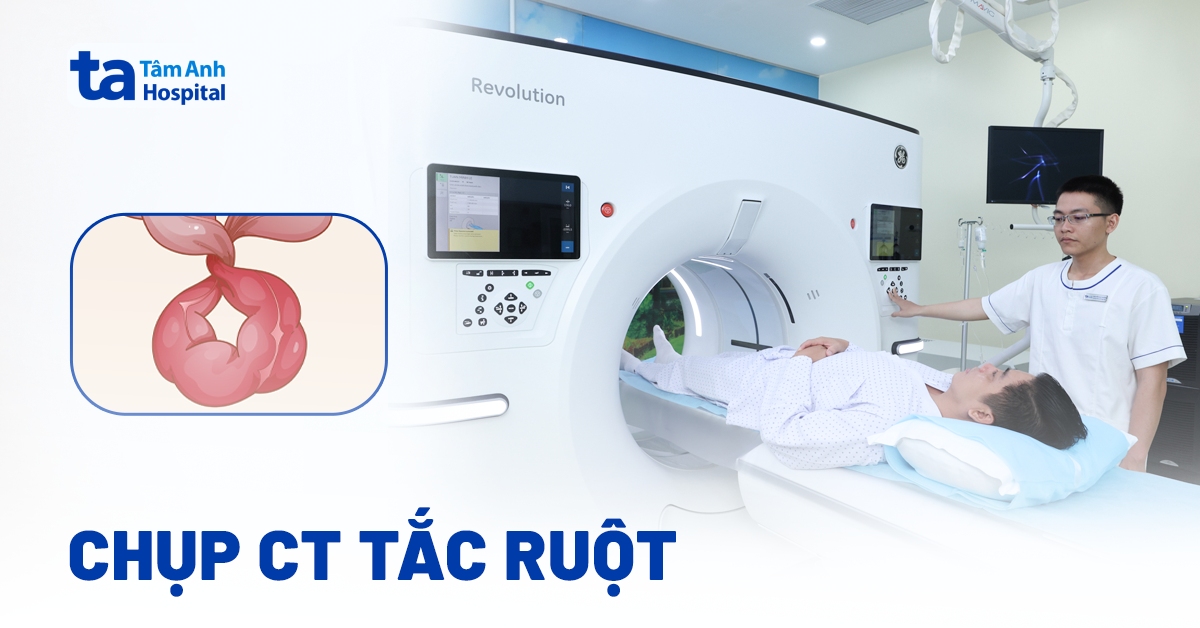 Chụp CT tắc ruột: Vai trò và quy trình thực hiện