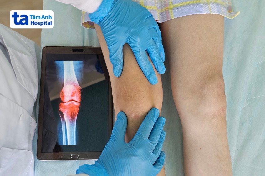 chụp x quang đánh giá bệnh viêm khớp dạng thấp