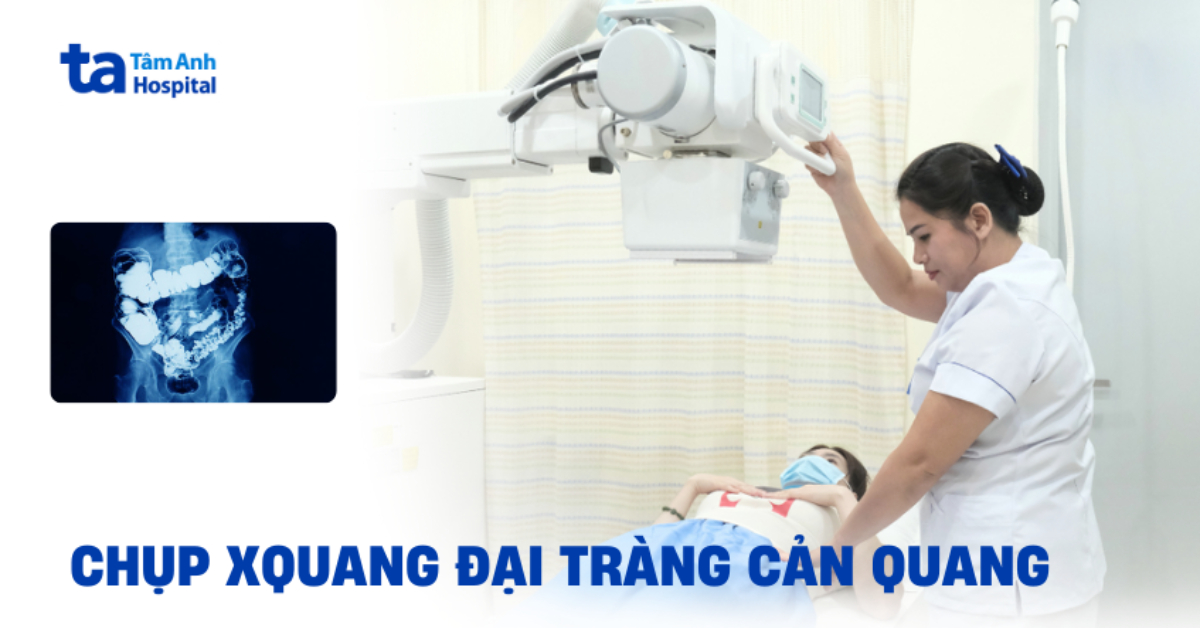 Chụp X Quang Đại Tràng Cản Quang