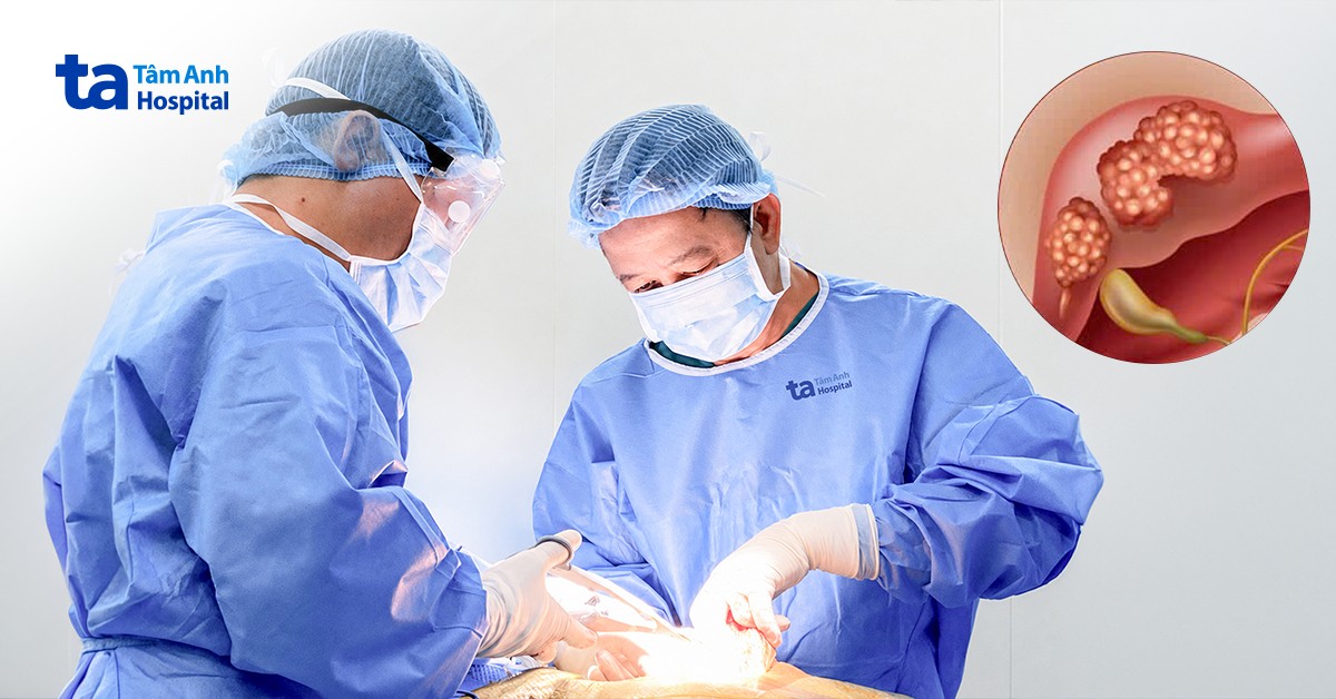 Cứu người bệnh có ba khối ung thư chiếm hơn 60% thể tích gan