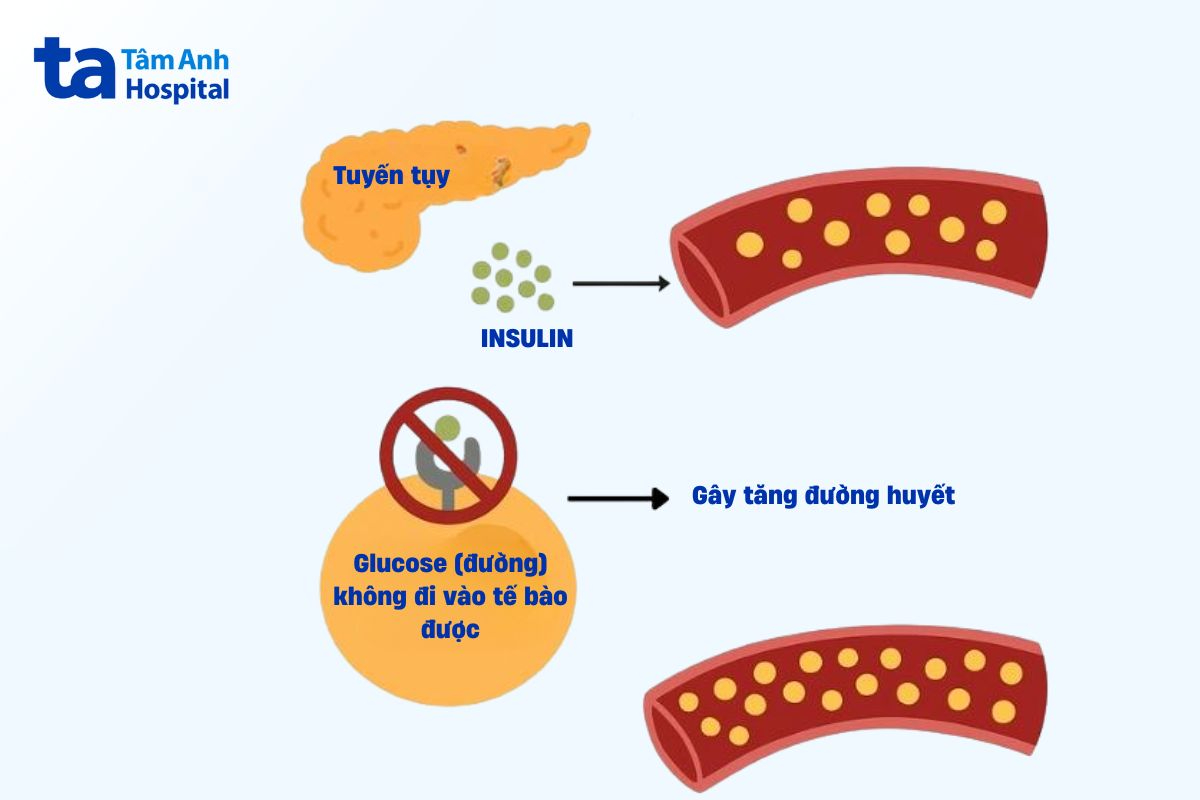 đái tháo đường là một bệnh nội tiết