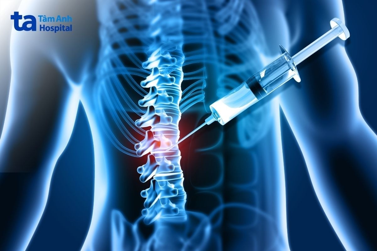 đau cột sống là biểu hiện của bệnh gì