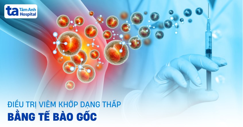 Tìm hiểu điều trị viêm khớp dạng thấp bằng tế bào gốc