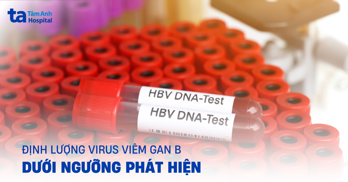 Định Lượng Virus Viêm Gan B Dưới Ngưỡng Phát Hiện Định Lượng Virus Viêm Gan B Dưới Ngưỡng Phát Hiện