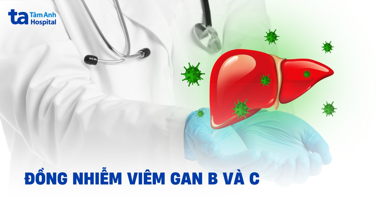 Đồng nhiễm viêm gan B và C: Nguyên nhân và điều trị