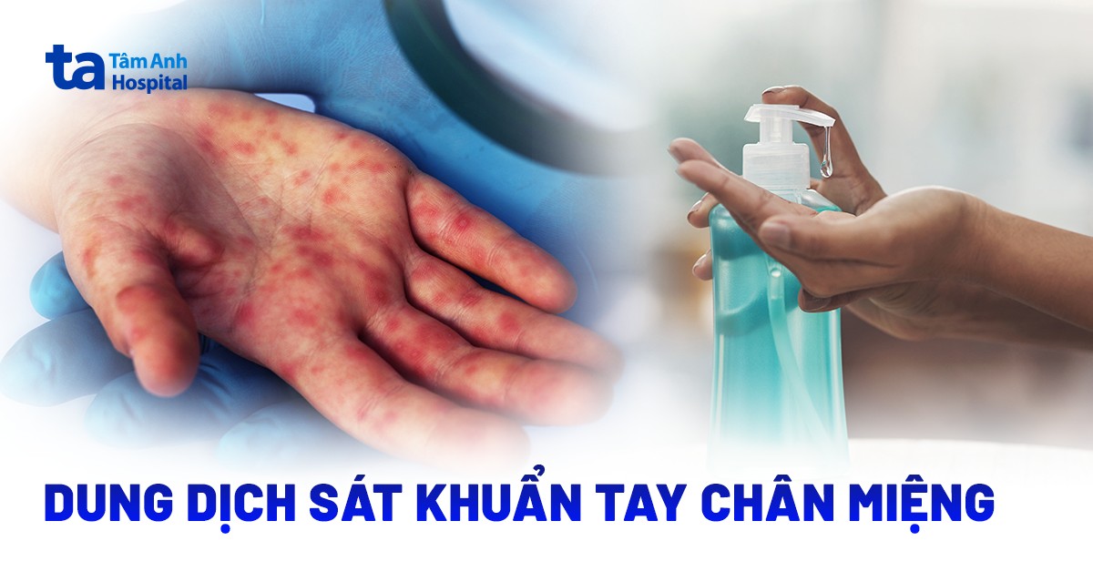 Các loại dung dịch sát khuẩn tay chân miệng phổ biến