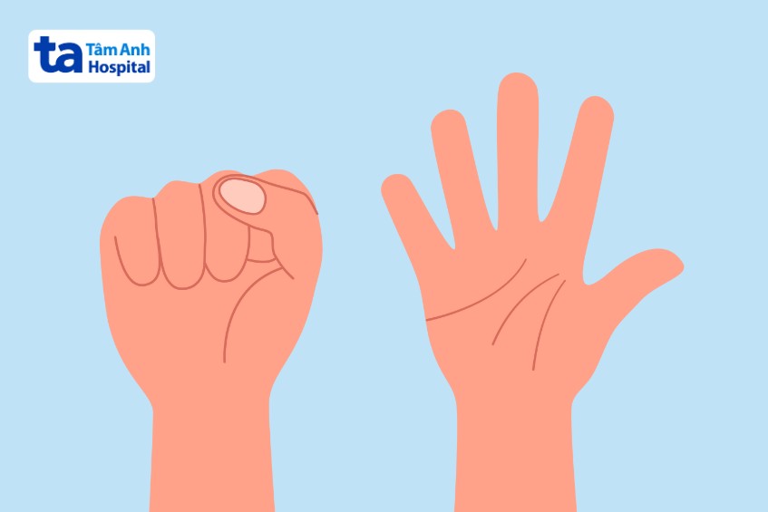 duỗi ngón tay cho người viêm khớp dạng thấp