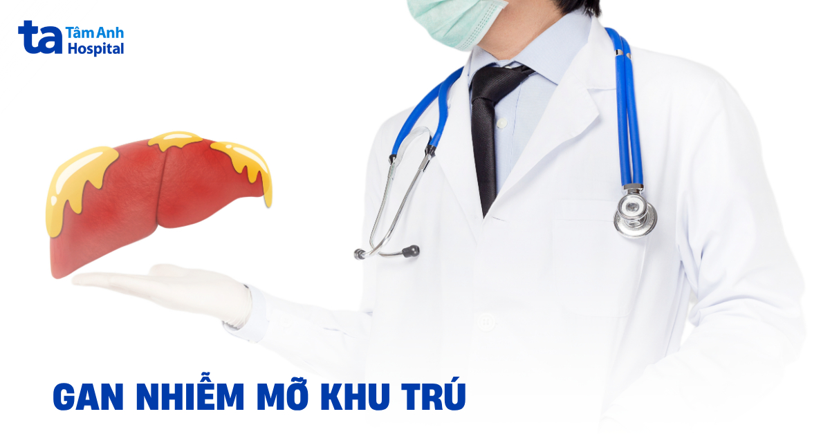 Gan nhiễm mỡ khu trú: Những điều người bệnh cần biết