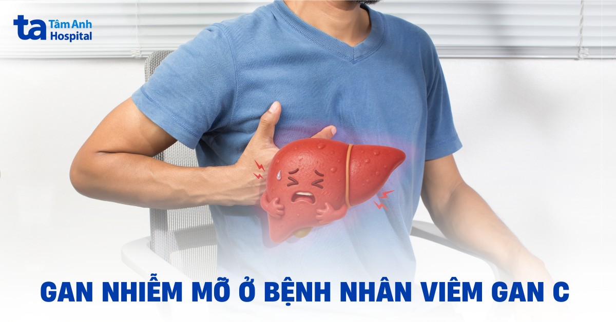 Nhận biết gan nhiễm mỡ ở bệnh nhân viêm gan C