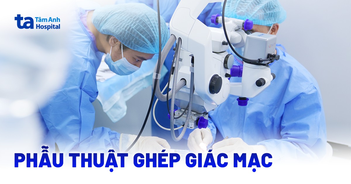 Phẫu thuật ghép giác mạc: Chỉ định, phương pháp và quy trình