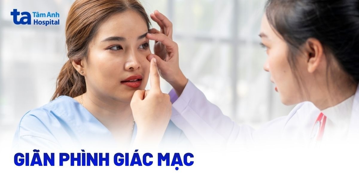 Giãn phình giác mạc và các thông tin chi tiết