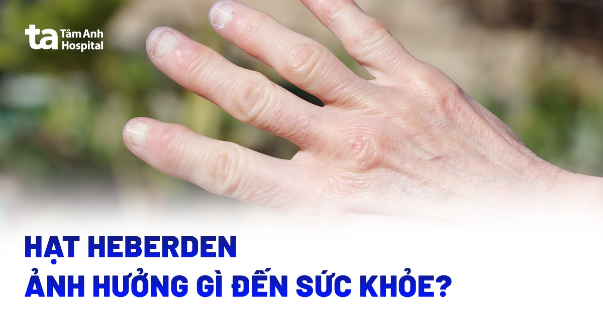 Hạt Heberden ảnh hưởng gì đến sức khỏe?