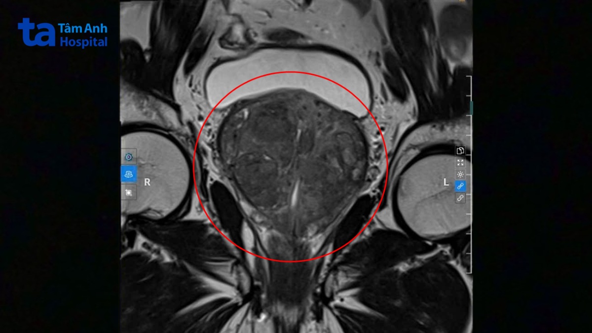 hình ảnh mri của khách hàng